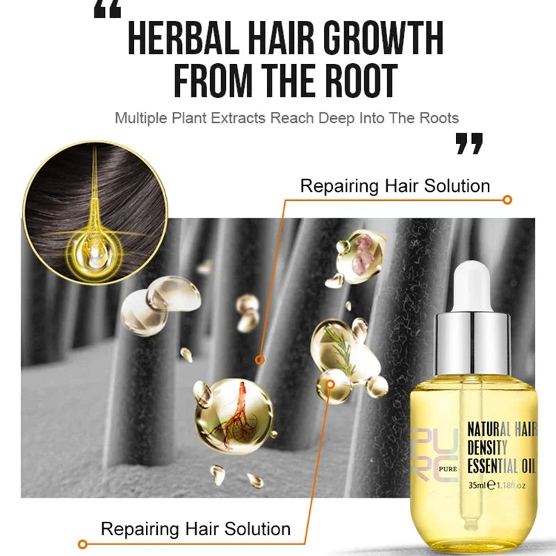 PURC Ginger Hair Growth Oil Fast Hair Loss Treatment Smoothing Repair Damaged Hair Growth Products for Men Women Hair Care